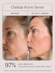 True Botanicals- Chebula Active Serum True Botanicals