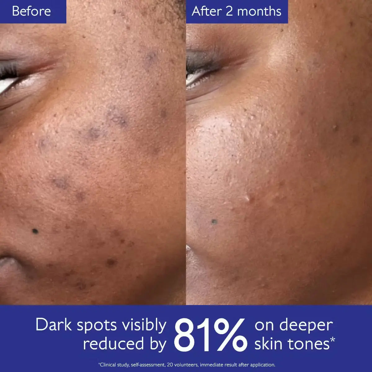 Caudelie- Vinoperfect Brightening Dark Spot Serum Vitamin C Alternative Caudelie