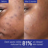 Caudelie- Vinoperfect Brightening Dark Spot Serum Vitamin C Alternative Caudelie