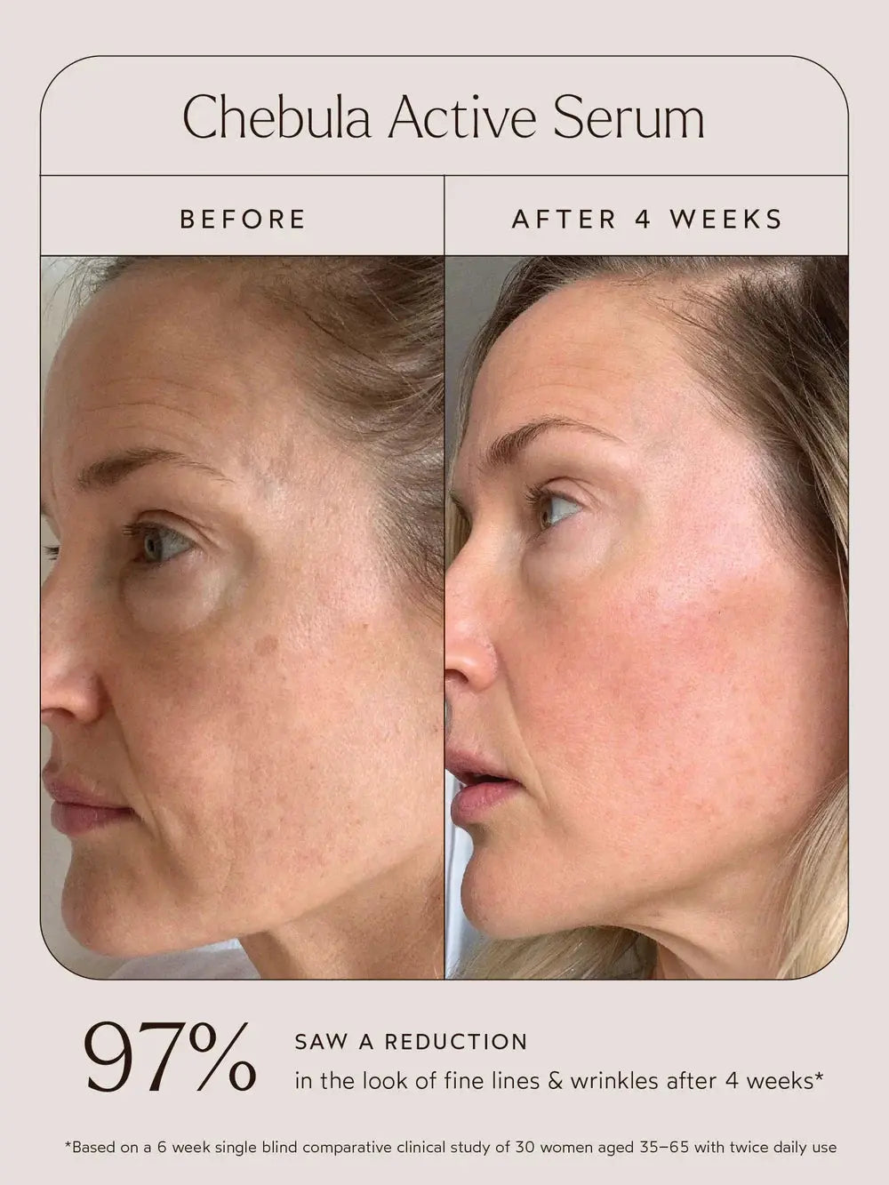 True Botanicals- Chebula Active Serum True Botanicals